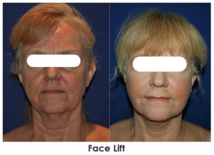 Cocoona Centre for Aesthetic Transformation