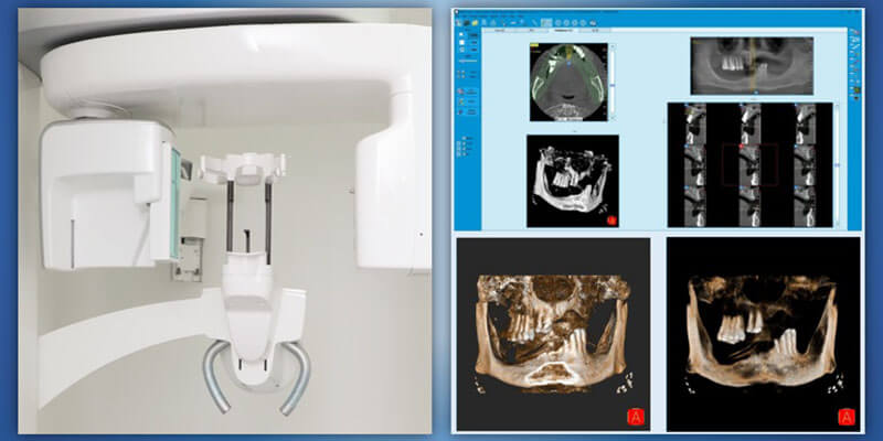 Vision Dental Clinic Abu Dhabi