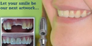 Vision Dental Clinic Abu Dhabi