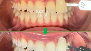 Vision Dental Clinic Abu Dhabi