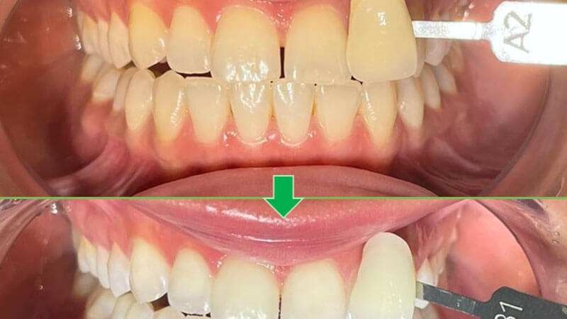 Vision Dental Clinic Abu Dhabi