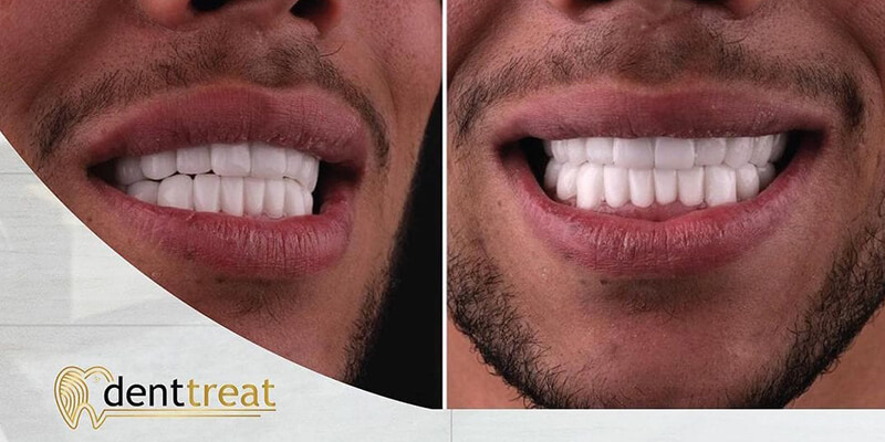 DentTreat Clinic