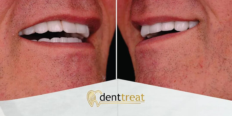 DentTreat Clinic