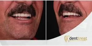 DentTreat Clinic