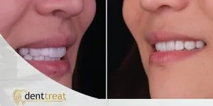DentTreat Clinic